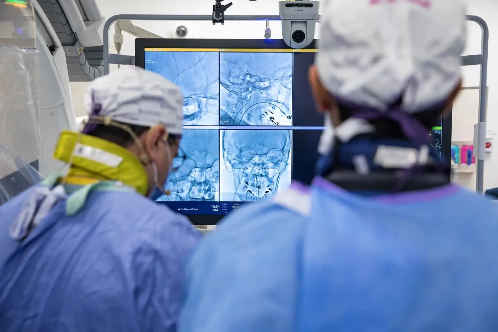 Neurosurgeons reviewing cerebral angiography images during a procedure